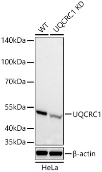 UQCRC1 Monoclonal Antibody&nbsp;<img src="images/icon_newarrival.gif" alt="new" border="0">