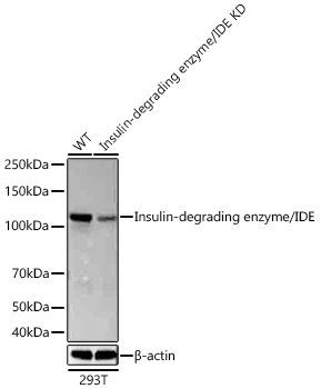 Insulin-degrading enzyme/IDE Monoclonal Antibody&nbsp;<img src="images/icon_newarrival.gif" alt="new" border="0">