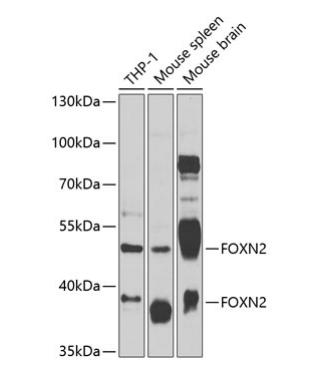 FOXN2 Polyclonal Antibody