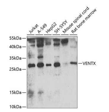 VENTX Polyclonal Antibody