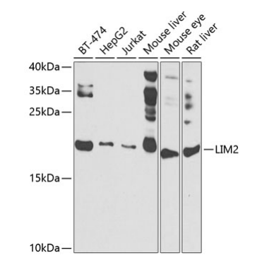 LIM2 Polyclonal Antibody