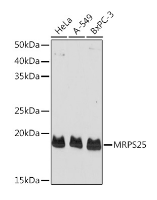 MRPS25 Polyclonal Antibody