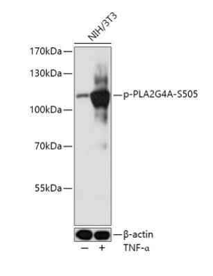 Phospho-PLA2G4A-S505 Polyclonal Antibody