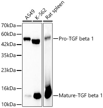 TGF beta 1 Monoclonal Antibody&nbsp;<img src="images/icon_newarrival.gif" alt="new" border="0">