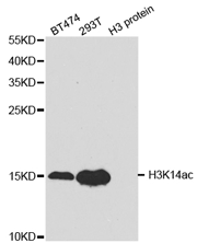 Western blot analysis of extracts of various cell lines, using Histone H3K14ac (Acetyl H3K14) Polyclonal Antibody.