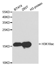 Western blot analysis of extracts of various cell lines, using Histone H3K18ac (Acetyl H3K18) Polyclonal Antibody.