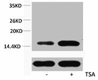 Western blot analysis of extracts from Hela cells, untreated (-) or treated, at a 1:2000 dilution using the Histone H3K36ac (Acetyl H3K36) Polyclonal Antibody.