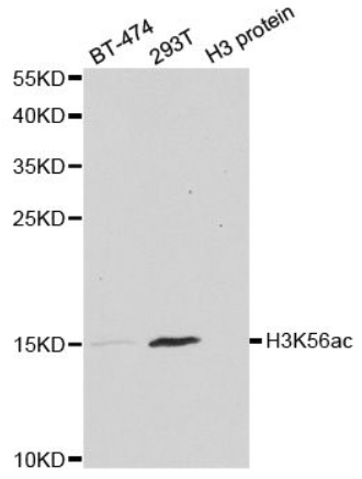 WB analysis of Histone H3K56ac (Acetyl H3K56) Polyclonal Antibody.