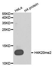 Western blot analysis of extracts of HeLa cell line and H4 protein expressed in E.coli., using Histone H4K20 Dimethyl Polyclonal Antibody.