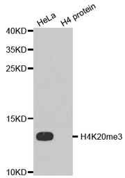 Western blot analysis of extracts of HeLa cell line and H4 protein expressed in E.coli., using H4K20me3 Polyclonal Antibody.
