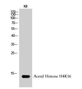 Western Blot analysis of KB cells using Histone H4K16ac (Acetyl H4K16) Polyclonal Antibody using the Histone H4K16ac (Acetyl H4K16) Polyclonal Antibody.