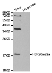Western blot analysis of extracts of HeLa cell line and H3 protein expressed in E.coli., using Histone H3R26 Dimethyl Asymmetric (H3R26me2a) Polyclonal Antibody.