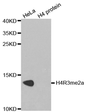 Western blot analysis of extracts of HeLa cell line and H4 protein expressed in E.coli., using Histone H4R3 Dimethyl Asymmetric (H4R3me2a) Polyclonal Antibody.
