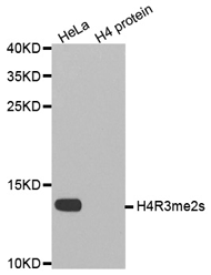 Western blot analysis of extracts of HeLa cell line and H4 protein expressed in E.coli., using Histone H4R3 Dimethyl Symmetric (H4R3me2s) Polyclonal Antibody.