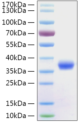 Recombinant SARS-CoV-2 Spike RBD Protein with His-Tag (100 µg)