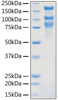Recombinant SARS-CoV-2 S1+S2 ECD (S-ECD) Protein with His-Tag