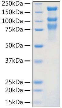 Recombinant SARS-CoV-2 S1+S2 ECD (S-ECD) Protein with His-Tag (100 µg)