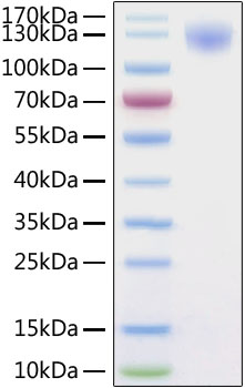 Recombinant SARS-CoV-2 Spike S1 Protein with His-Tag (100 µg)