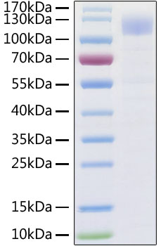 Recombinant SARS-CoV-2 Spike S1 Protein with His-Tag