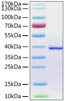 Recombinant SARS-CoV-2 Papain-like Protease with His-Tag (100 µg)