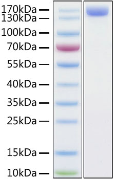 Recombinant ACE2 Protein with hFc Tag