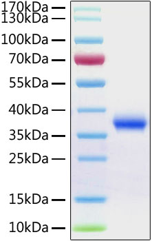 Recombinant SARS-CoV-2 Spike RBD Protein with His-Tag