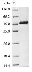 Recombinant TMPRSS2 Protein, Partial