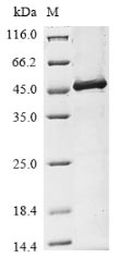 Recombinant TMPRSS2 Protein, Partial (20 µg)