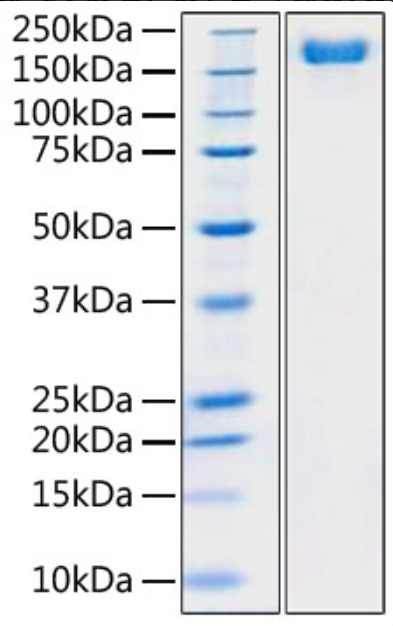 Recombinant SARS-COV-2 S1+S2 ECD(S-ECD) Protein with His tag (Pre-Fusion) (100 µg)