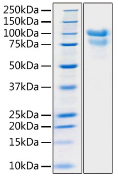 Recombinant SARS-COV-2 S1+S2 ECD(S-ECD) Protein with His tag (Post-Fusion)