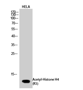 Western Blot analysis of HELA cells using Histone H4K5ac (Acetyl H4K5) Polyclonal Antibody