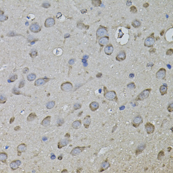 Immunohistochemistry of paraffin-embedded rat brain using CLIMP-63 Polyclonal Antibody.
