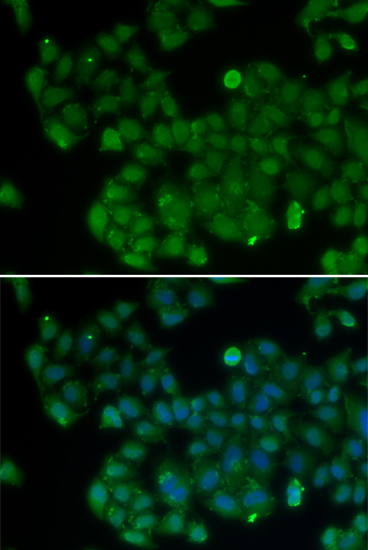 Immunofluorescence - DNMT3L Polyclonal Antibody