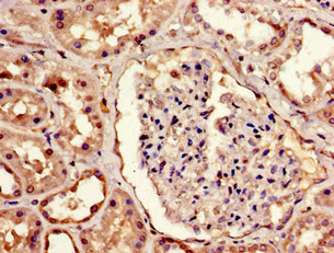 Immunohistochemistry of paraffin-embedded human kidney tissue using MBD1 Polyclonal Antibody.