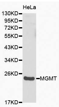 Western blot analysis of Hela cell lysate using MGMT Polyclonal Antibody.