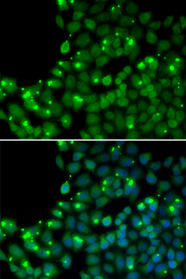 Immunofluorescence analysis of U20S cell using MGMT Polyclonal Antibody. Blue: DAPI for nuclear staining.