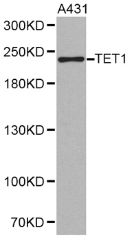 Western blot analysis of TET1 Polyclonal Antibody
