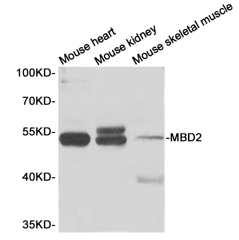 Western blot analysis of extracts of various cells, using MBD2 Polyclonal Antibody.