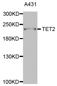 Western Blot of TET2 Polyclonal Antibody