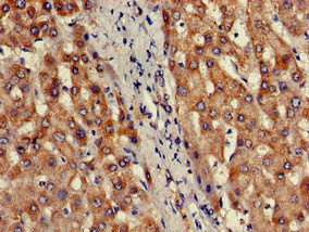 Immunohistochemistry of paraffin-embedded human liver tissue using PRDM2 Polyclonal Antibody at dilution of 1:100