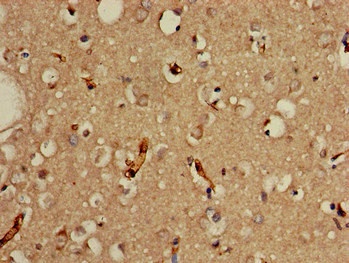 Immunohistochemistry of paraffin-embedded human brain tissue using PRDM2 Polyclonal Antibody at dilution of 1:100