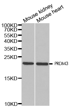 Western blot analysis of extracts of various cell lines, using PRDM3 Polyclonal Antibody.