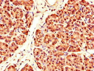 Immunohistochemistry of paraffin-embedded human pancreatic tissue using PRDM4 Polyclonal Antibody at dilution of 1:100