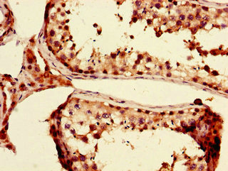 Immunohistochemistry of paraffin-embedded human testis tissue using PRDM4 Polyclonal Antibody at dilution of 1:100