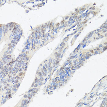 Immunohistochemistry - PRDM14 Polyclonal Antibody