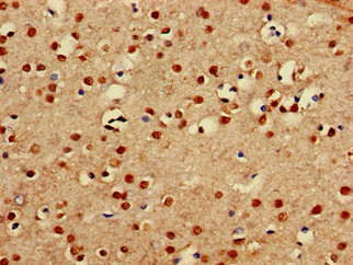 Immunohistochemistry of paraffin-embedded human brain tissue using PRDM16 Polyclonal Antibody at dilution of 1:100