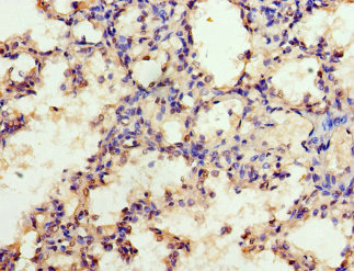 Immunohistochemistry of paraffin-embedded human lung tissue at dilution of 1:100
