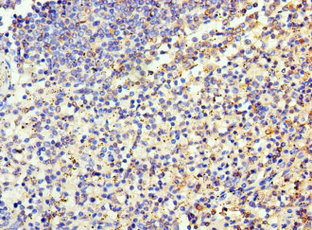 Immunohistochemistry of paraffin-embedded human spleen tissue at dilution of 1:100