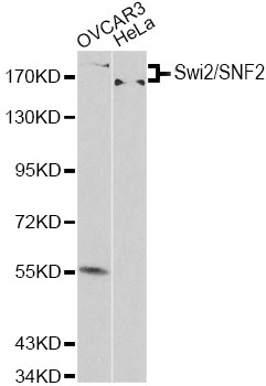 Westernblot image of Swi2/SNF2 Polyclonal Antibody.