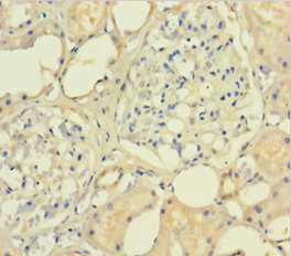 Immunohistochemistry of paraffin-embedded human kidney tissue using Ini1 Polyclonal Antibody at dilution of 1:100
